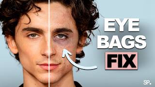 Remove Eye Bags Forever!